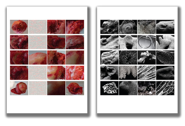 Cosmopolitical Futures - Human Donor Series – Visceral - Photographic Diptych